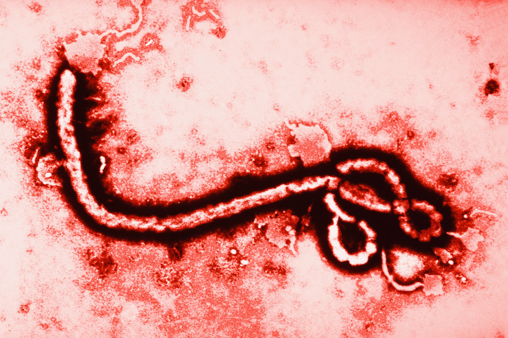 Ebola Virus at 108,000 Magnification